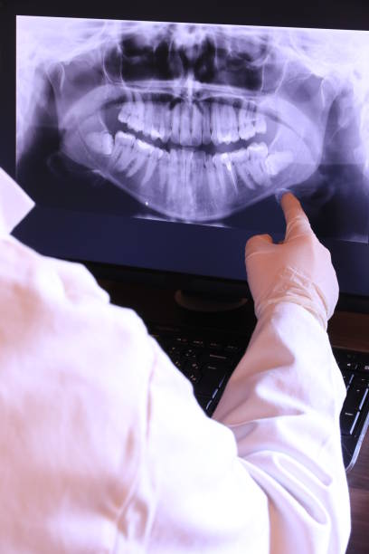 Best Emergency Root Canal Treatment in Richmond, VA
