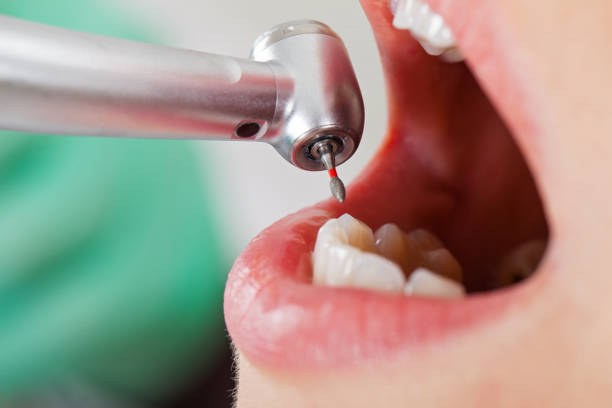 Best Same-Day Emergency Dentist in Richmond, VA
